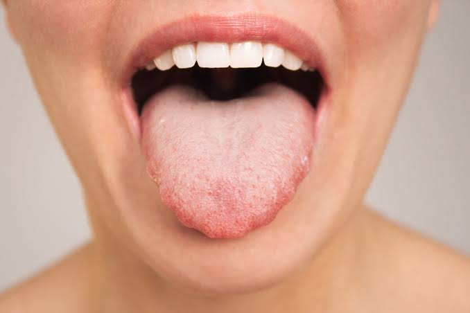 Understanding the Oral Microbiome